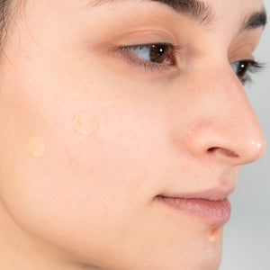 acne pimple patch